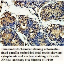 ZNF83 Antibody