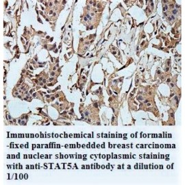 STAT5A Antibody