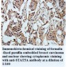 STAT5A Antibody