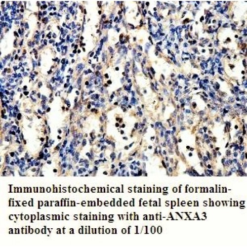 ANXA3 Antibody