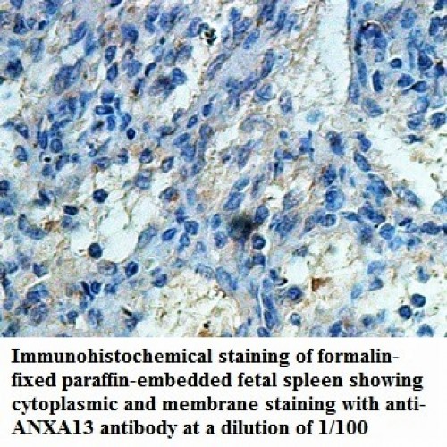 ANXA13 Antibody