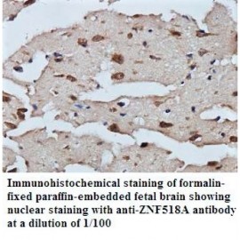ZNF518A Antibody