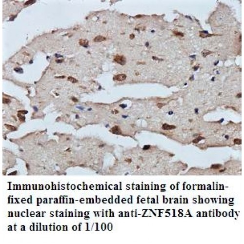 ZNF518A Antibody