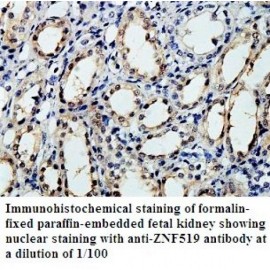 ZNF519 Antibody