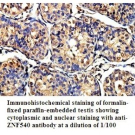 ZNF540 Antibody