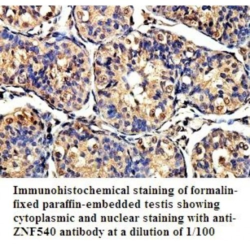 ZNF540 Antibody