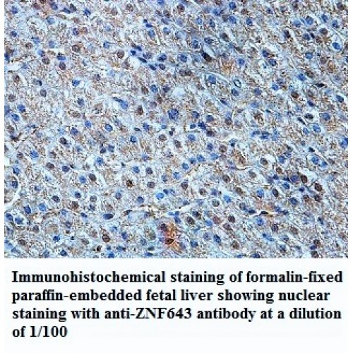 ZNF643 Antibody