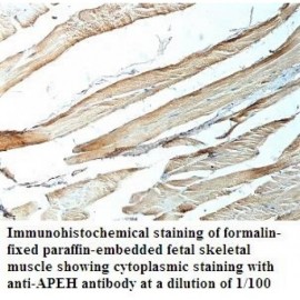 APEH Antibody