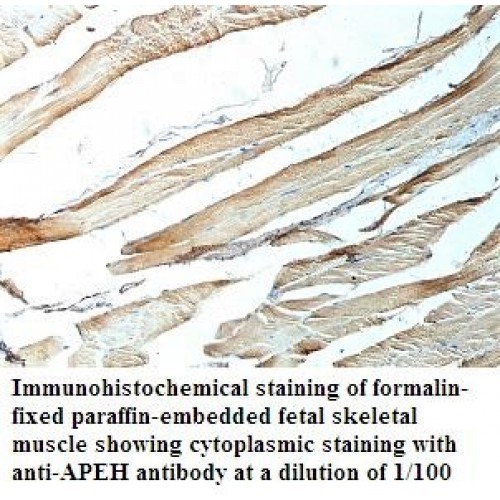 APEH Antibody