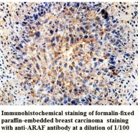 ARAF Antibody