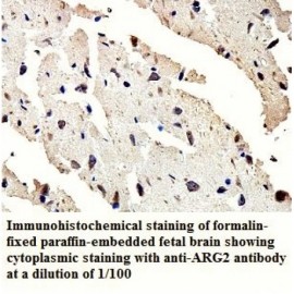 ARG2 Antibody