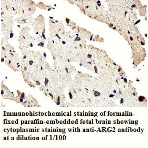 ARG2 Antibody