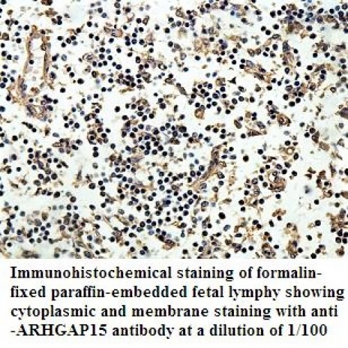 ARHGAP15 Antibody