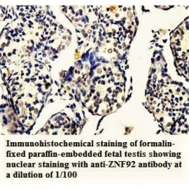 ZNF92 Antibody