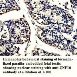 ZNF10 Antibody