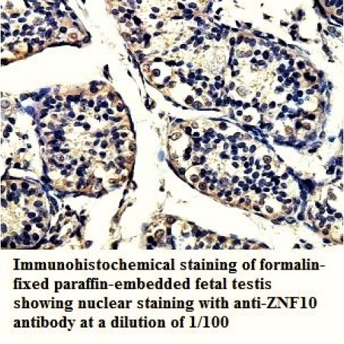 ZNF10 Antibody