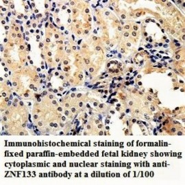 ZNF133 Antibody