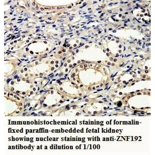 ZNF192 Antibody