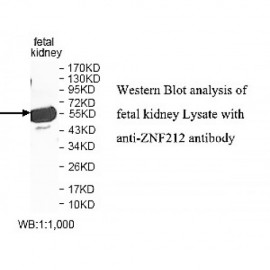 ZNF212 Antibody