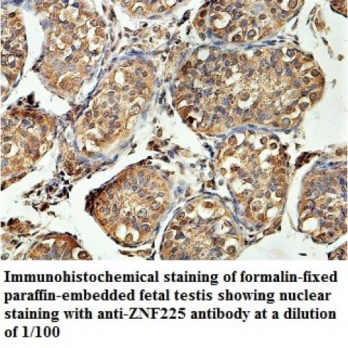 ZNF225 Antibody