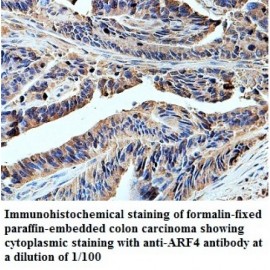ARF4 Antibody