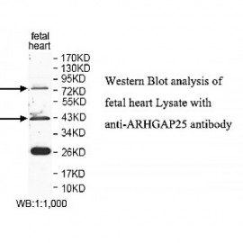 ARHGAP25 Antibody