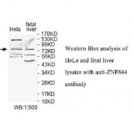 ZNF844 Antibody