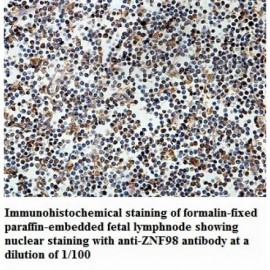 ZNF98 Antibody