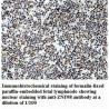 ZNF98 Antibody