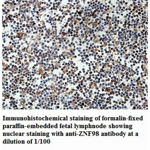 ZNF98 Antibody