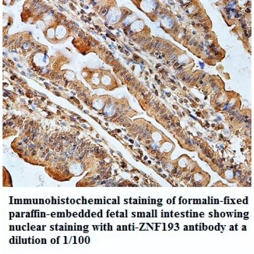 ZNF195 Antibody