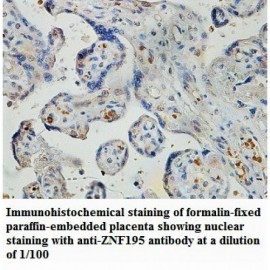 ZNF193 Antibody