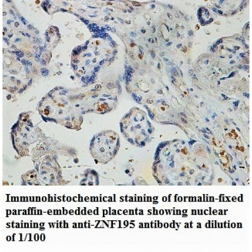 ZNF193 Antibody