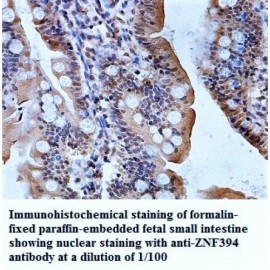 ZNF394 Antibody