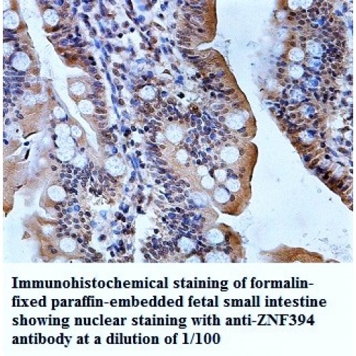 ZNF394 Antibody