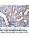 TIGAR Antibody