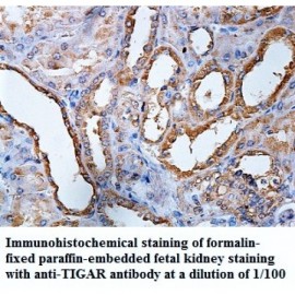 TIGAR Antibody