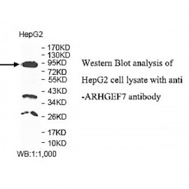 ARHGEF7 Antibody
