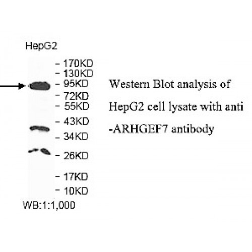 ARHGEF7 Antibody