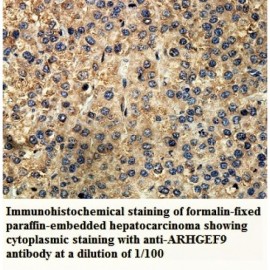 ARHGEF9 Antibody