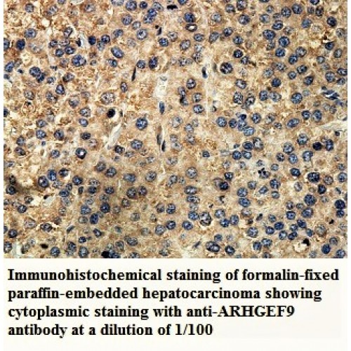 ARHGEF9 Antibody