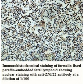 ZNF22 Antibody