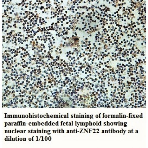 ZNF22 Antibody