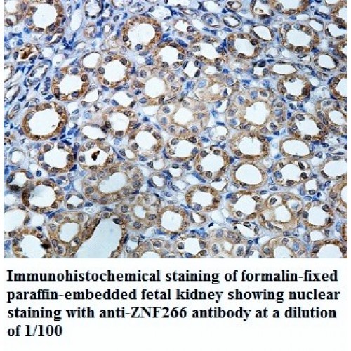 ZNF266 Antibody