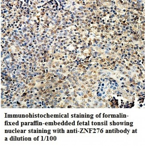 ZNF276 Antibody