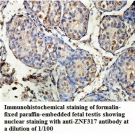 ZNF317 Antibody
