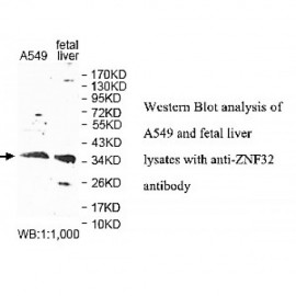 ZNF32 Antibody