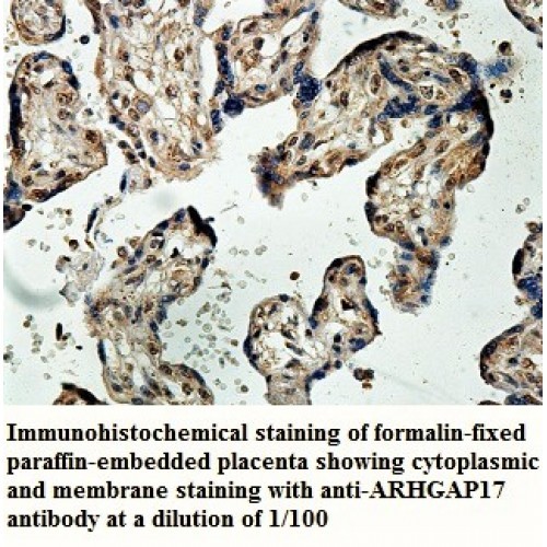 ARHGAP17 Antibody