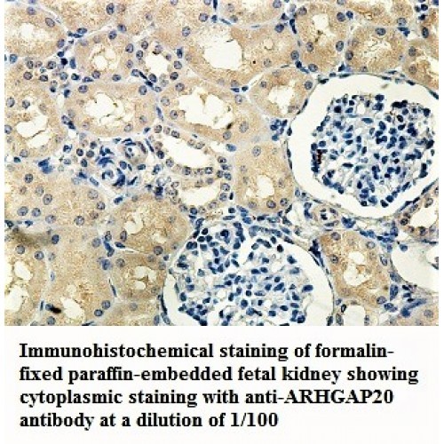 ARHGAP20 Antibody