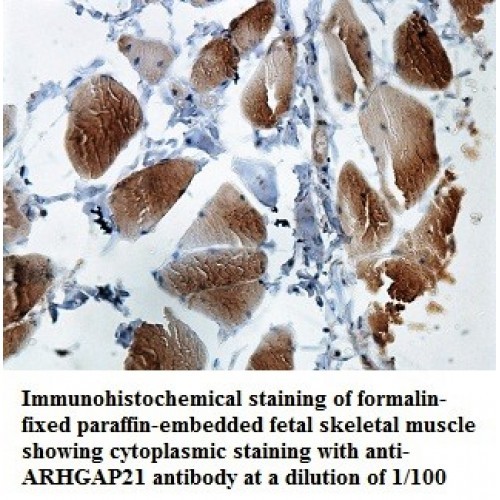ARHGAP21 Antibody